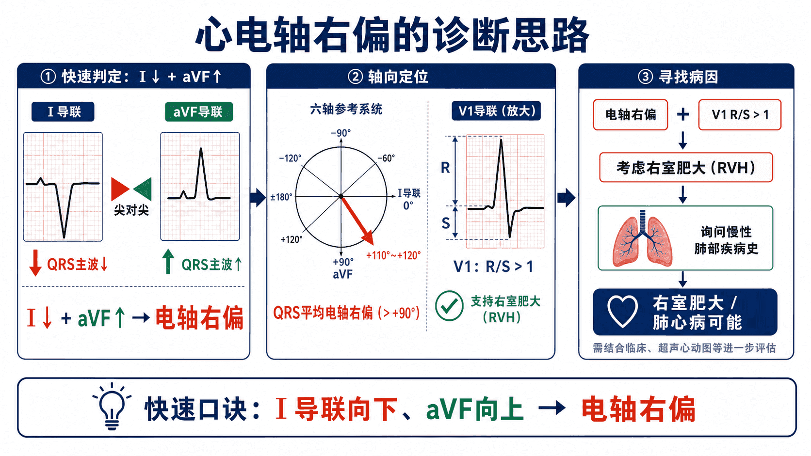 右轴偏移的推演：I 导联主波向下、aVF 向上，六轴系统约 +110°，再看 V1 R/S 是否大于 1 并结合慢性肺部疾病史