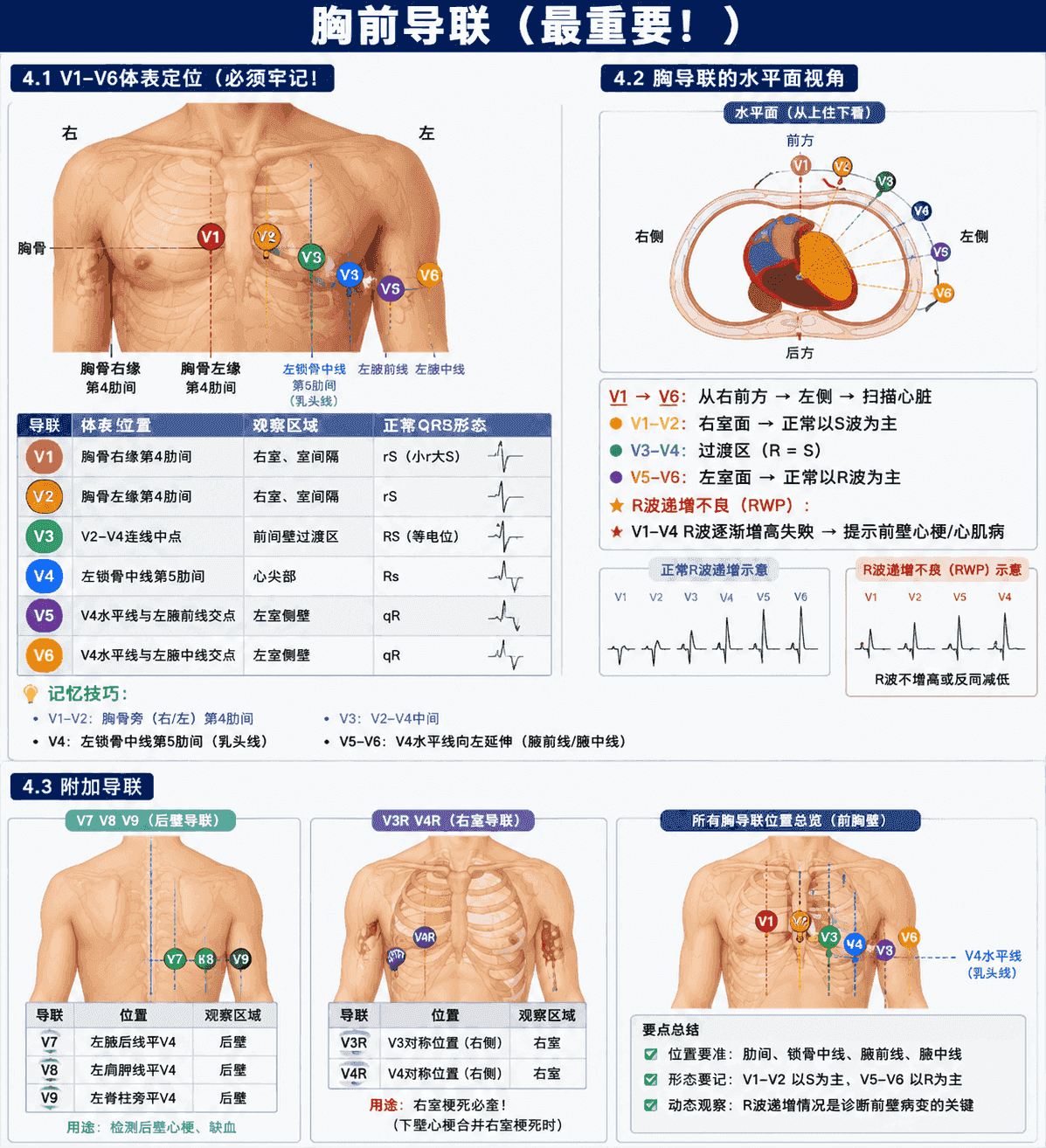 胸前导联 V1–V6 定位与附加导联