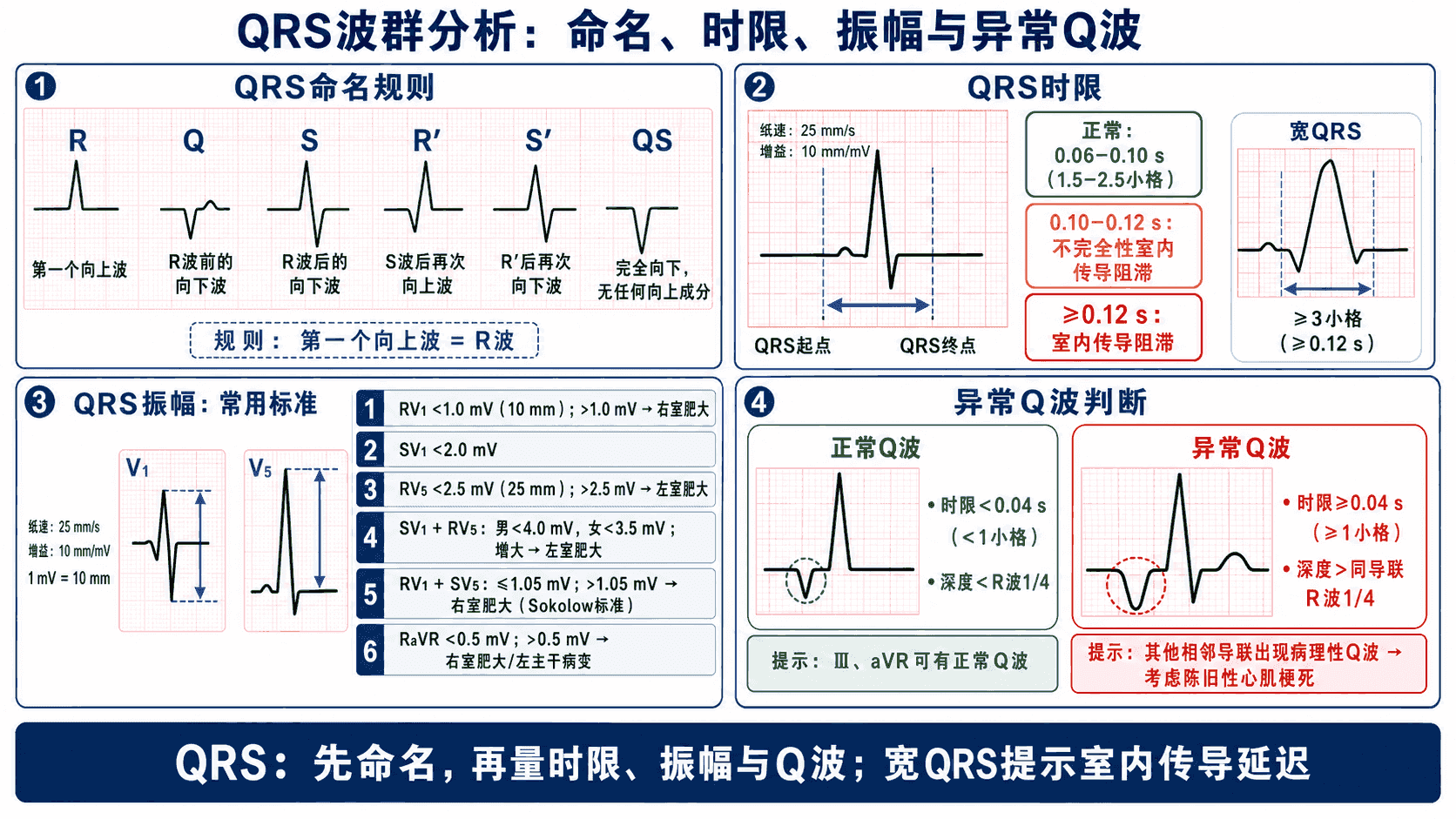 QRS波群分析四步:命名规则、时限 0.06–0.10s、V₁与V₅振幅标准,以及异常Q波的时限与深度判据